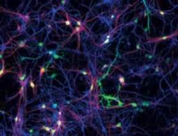 brain-synapsis-2